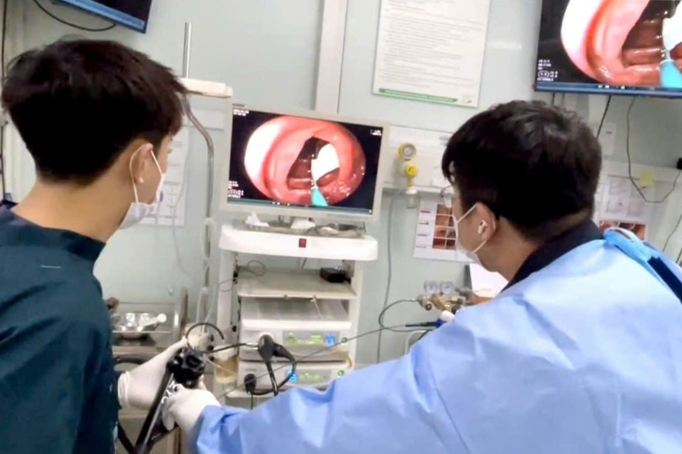Các bác sỹ nội soi gắp con sán trong đại tràng của bệnh nhân (Ảnh: BVCC)