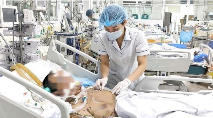 Bệnh nhân bị tổn thương phổi nặng do mắc thủy đậu (Ảnh: BVCC)