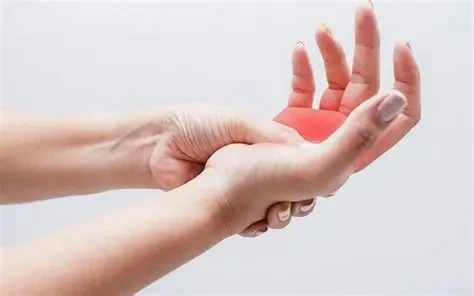 Hội chứng ống cổ tay thường gặp ở người làm việc máy tính, lao động thủ công hoặc sử dụng tay lặp đi lặp lại trong thời gian dài. (Ảnh: Sưu tầm)