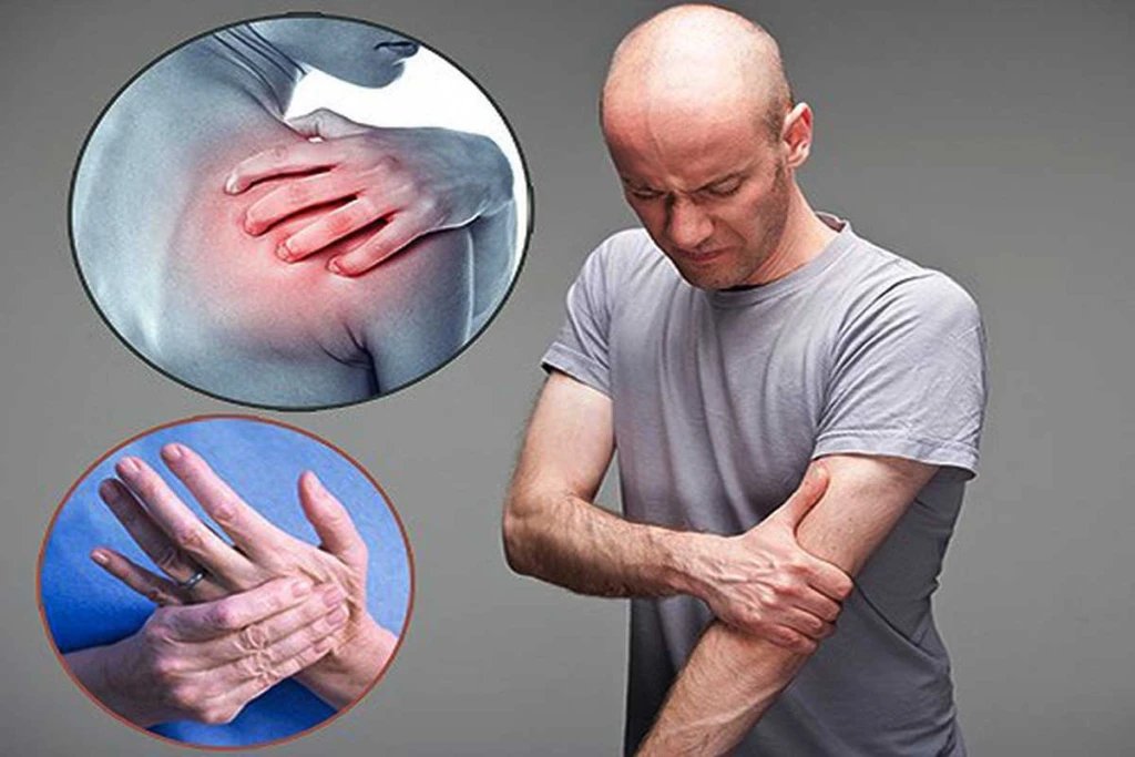 Đau cổ vai gáy lan xuống tay (Ảnh: Sưu tầm)