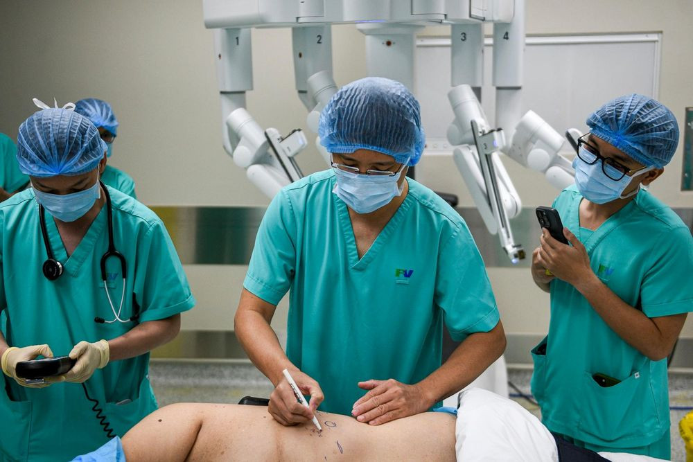 Ngay sau khi bệnh nhân được gây mê nội khí quản ổn định, bác sĩ Thanh dùng bút chuyên dụng tỉ mỉ vẽ sơ đồ các vị trí đặt cánh tay robot trên ngực bà Bích. Những nét vẽ này được tính toán chuẩn xác dựa trên hình ảnh CT, nhằm xác định 