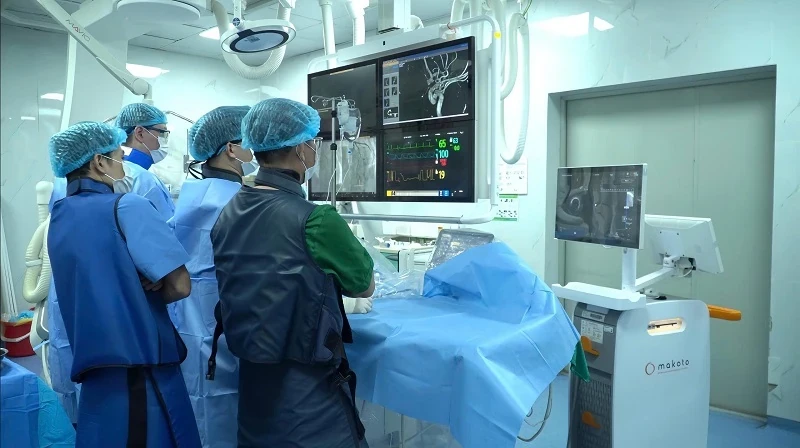 Ca can thiệp mạch vành phức tạp dưới sự hỗ trợ của hệ thống IVUS + NIRS được thực hiện tại Bệnh viện Đa khoa Hợp Lực (Ảnh: TD)