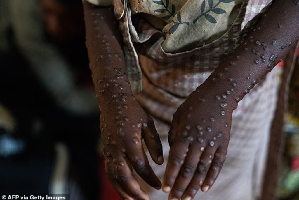 Ảnh: AFP/Getty Images