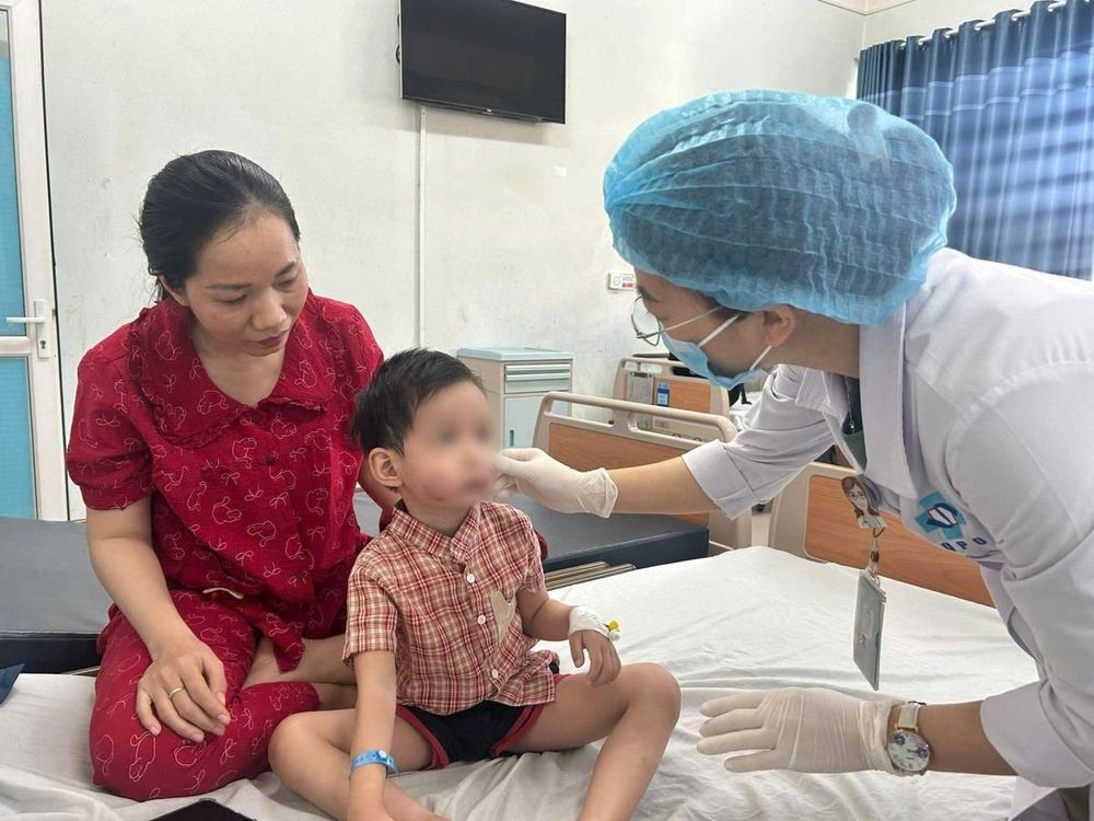 Bệnh nhi G.H được gia đình đưa đến cấp cứu trong tình trạng có nhiều vết thương vùng mặt (Ảnh: BVCC)