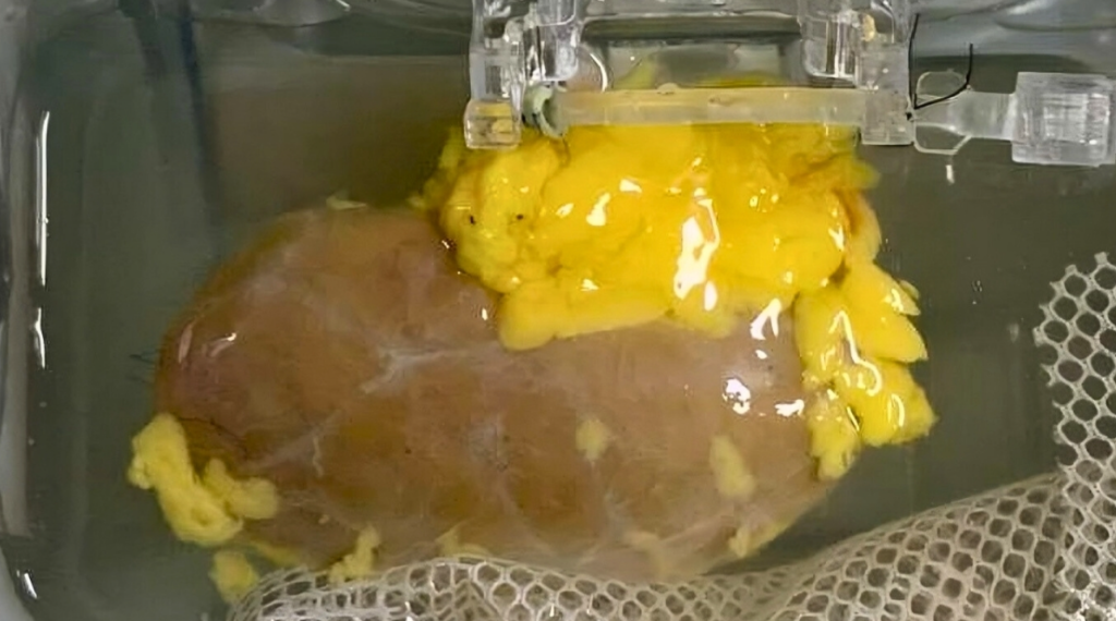 Quá trình chuẩn bị thận trong phòng thí nghiệm (Ảnh: Nature Biomedical Engineering)