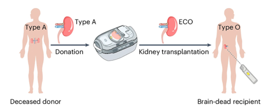 Các nhà khoa học đã biến đổi thành công thận nhóm A sang trạng thái tương đương nhóm O bằng enzyme, sẵn sàng cho việc cấy ghép (Ảnh: Nature Biomedical Engineering)