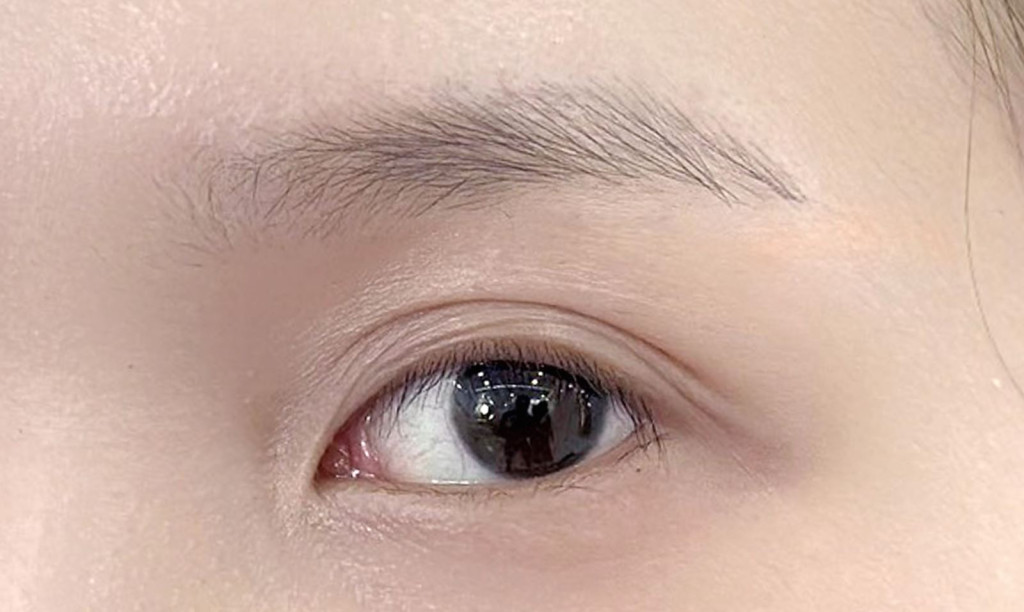 Xác định đúng nguyên nhân để tìm cách điều trị hợp lý (Ảnh: Sưu tầm)