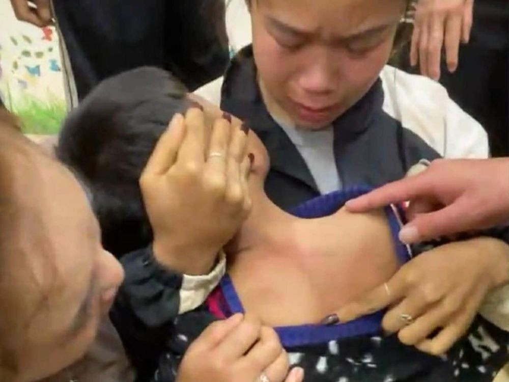 Trên lưng em Phước có nhiều vết đỏ nghi bị đánh (Ảnh chụp màn hình)