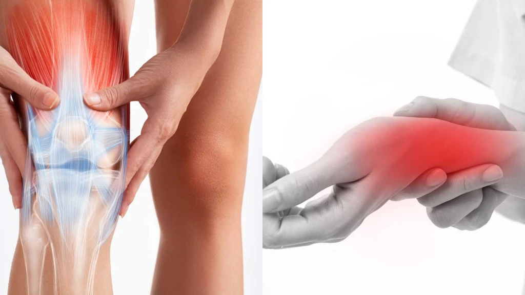 Khớp gối là vị trí thường gặp tình trạng tràn dịch do chấn thương hoặc bệnh lý viêm khớp. (Ảnh: Sưu tầm)