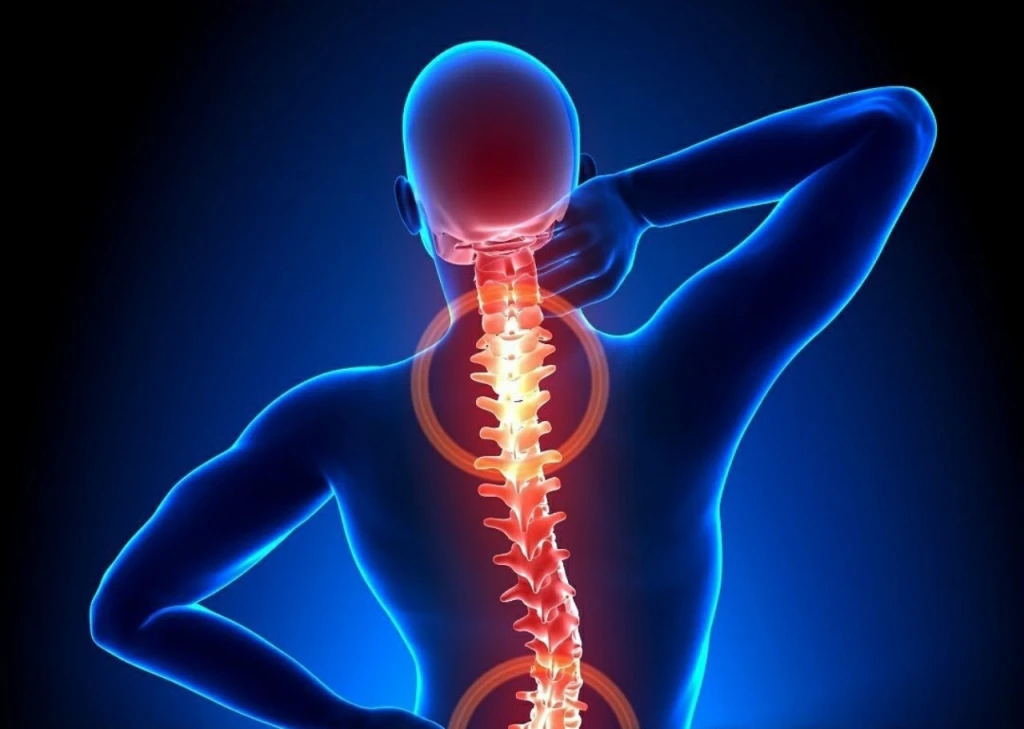 Người hút thuốc có nguy cơ đau lưng mạn tính cao hơn đáng kể so với người không hút (Ảnh: Sưu tầm)