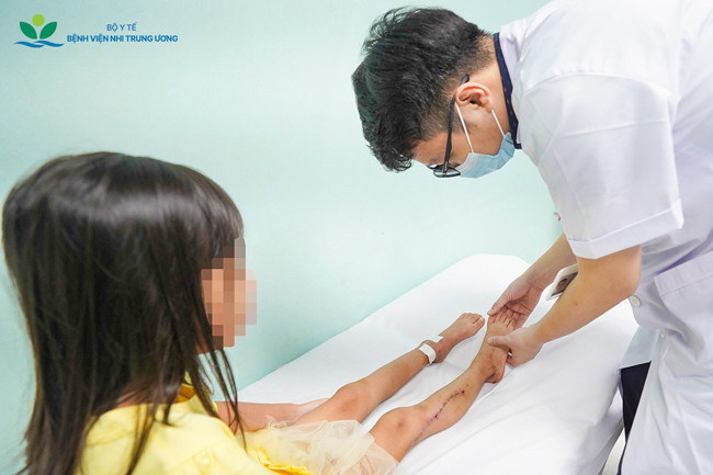 Bệnh nhi được kiểm tra mức độ hồi phục tại khoa Phục hồi chức năng (Ảnh: BVCC)