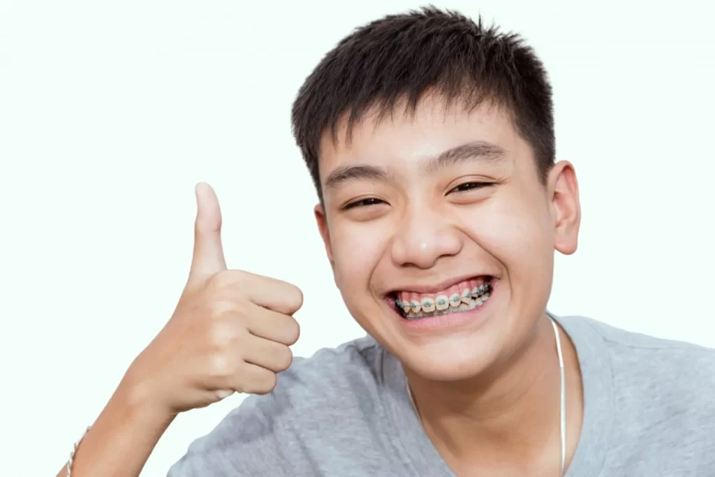 Chỉnh nha muộn khiến quá trình điều trị phức tạp và mất nhiều thời gian (Ảnh: Sưu tầm)