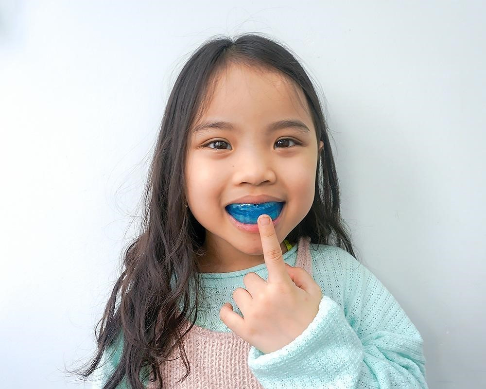 Từ 8-14 tuổi được xem là thời điểm lý tưởng để niềng răng (Ảnh: Sưu tầm)