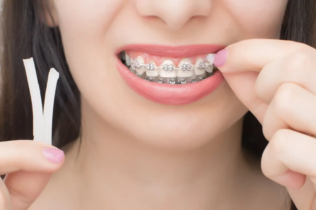 Vệ sinh tay và răng miệng trước khi dùng sáp nha khoa (Ảnh: Sưu tầm)