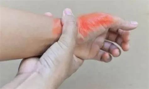 Người có axit uric cao nên uống đủ nước và bổ sung thực phẩm giàu vitamin C, chất xơ để hỗ trợ đào thải axit uric ra khỏi cơ thể. (Ảnh: Sưu tầm)