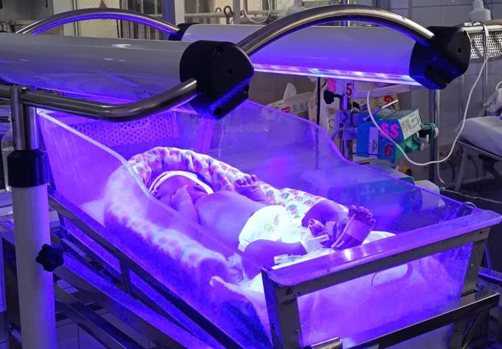 Trẻ được chiếu đèn ngay sau sinh để điều trị vàng da (Ảnh: BVCC)