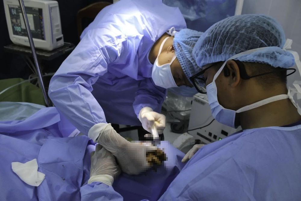 Các y, bác sĩ phẫu thuật cho bệnh nhân (Ảnh: BVCC)