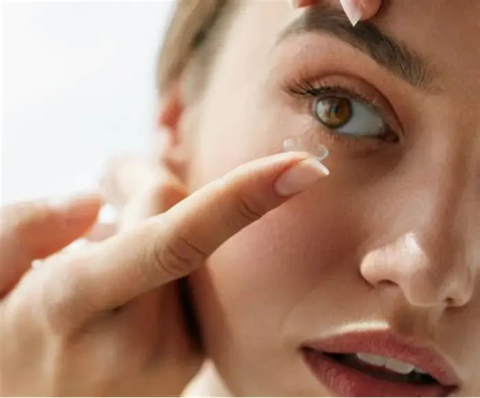 Đeo lens sai cách hoặc quá lâu có thể khiến mắt bị đỏ, khô và kích ứng. (Ảnh: Sưu tầm)