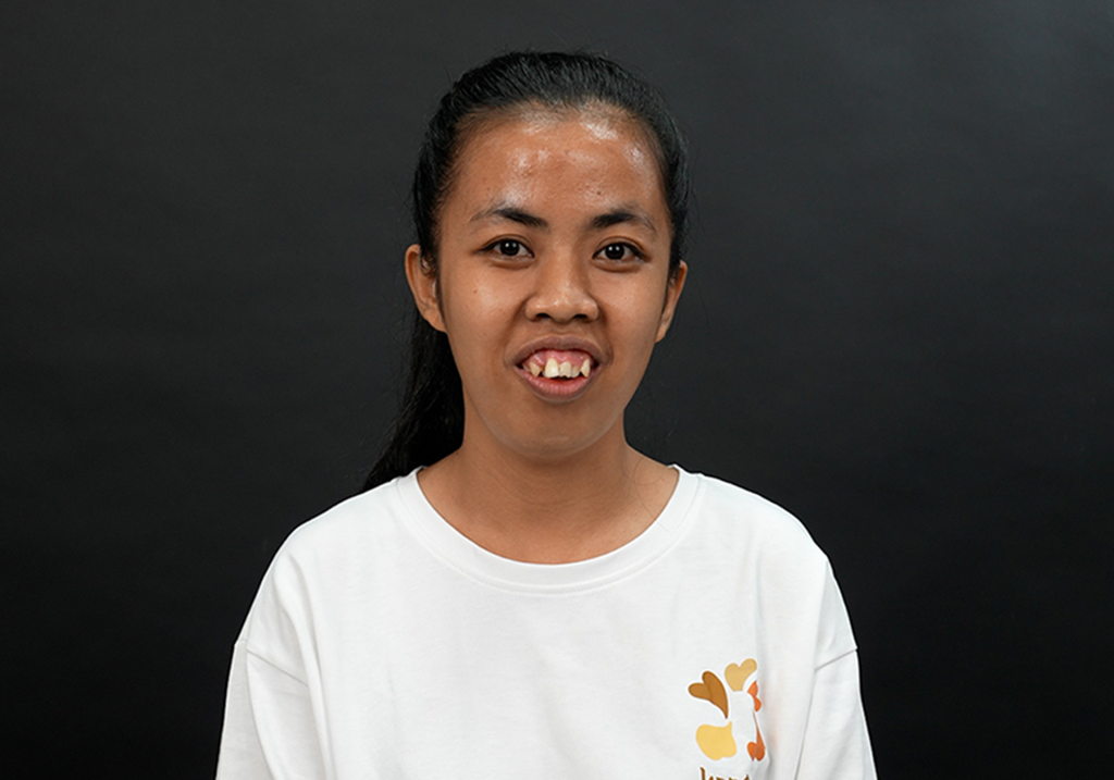 Trà My trước khi trải qua 
