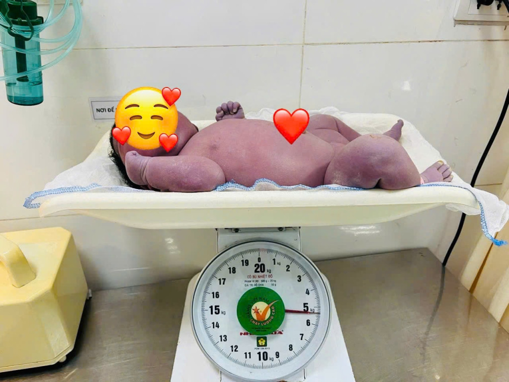 Bé trai 5,4kg chào đời trong ca mổ đặc biệt (Ảnh: BVCC)