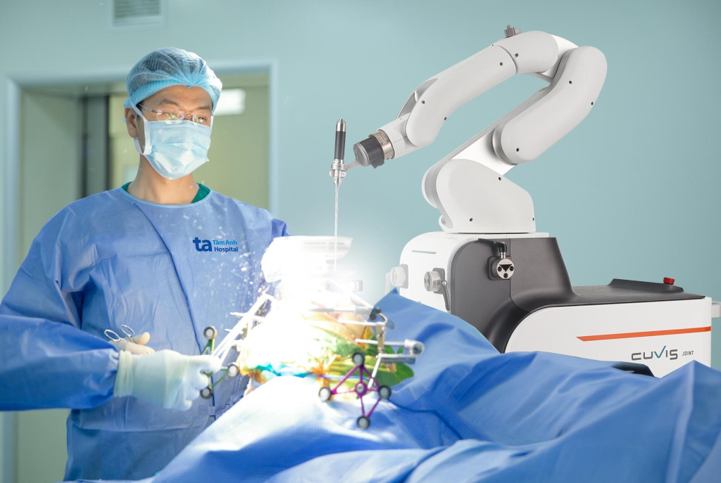 Cánh tay Robot CUVIS-Joint chủ động cắt xương chuẩn xác từng milimet theo kế hoạch (Ảnh: BVĐK Tâm Anh)