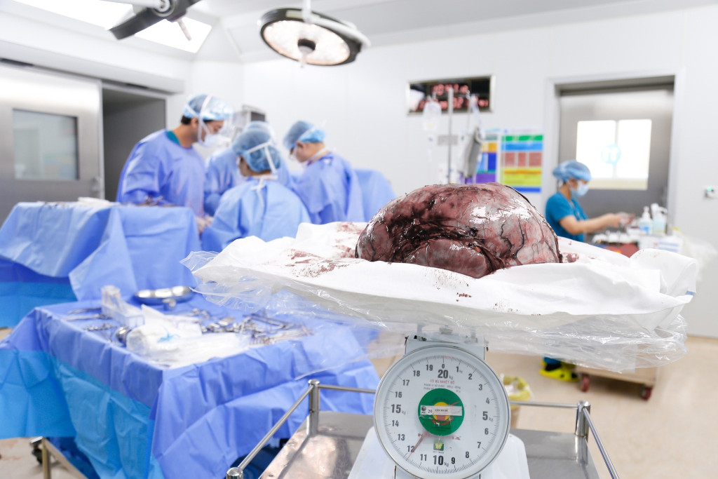 Khối u xơ tử cung khổng lồ gần 12kg được lấy ra trong người bệnh nhân (Ảnh: BVCC)