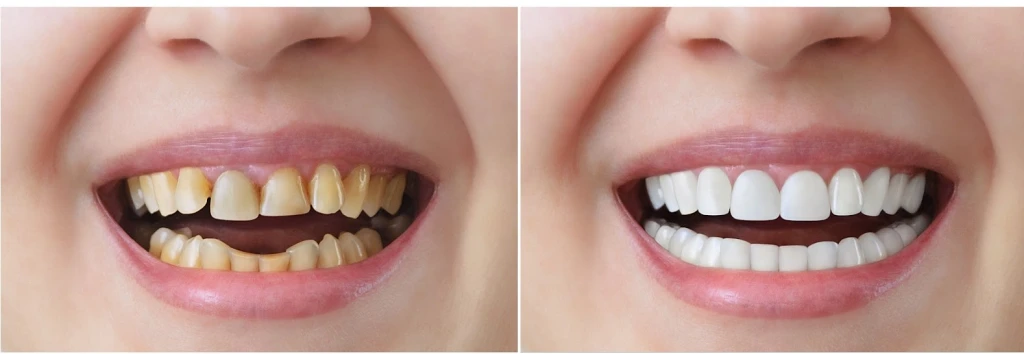 Phương pháp thẩm mỹ được nhiều người lựa chọn (Ảnh: Sưu tầm)