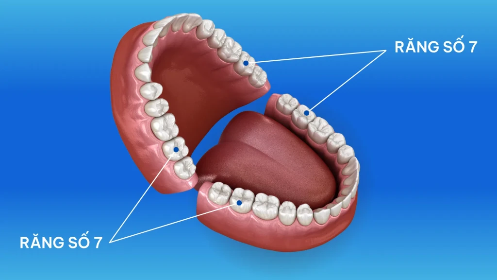 Vị trí răng số 7 (Ảnh: Sưu tầm)