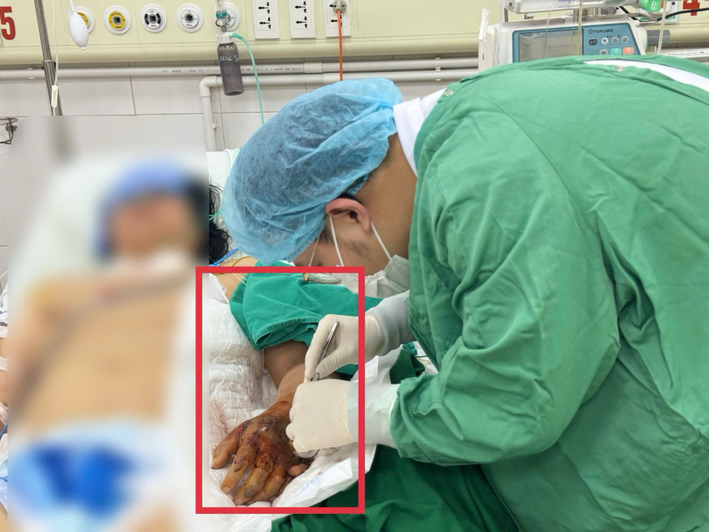 Bác sĩ tiến hành điều trị cho bệnh nhân (Ảnh: BVCC)