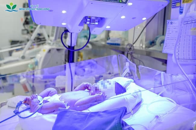 Trước khi truyền, máu được xử lý, tách thành phần hồng cầu và sàng lọc theo quy trình nghiêm ngặt nhằm hạn chế nguy cơ phản ứng miễn dịch cho trẻ (Ảnh: BVCC)