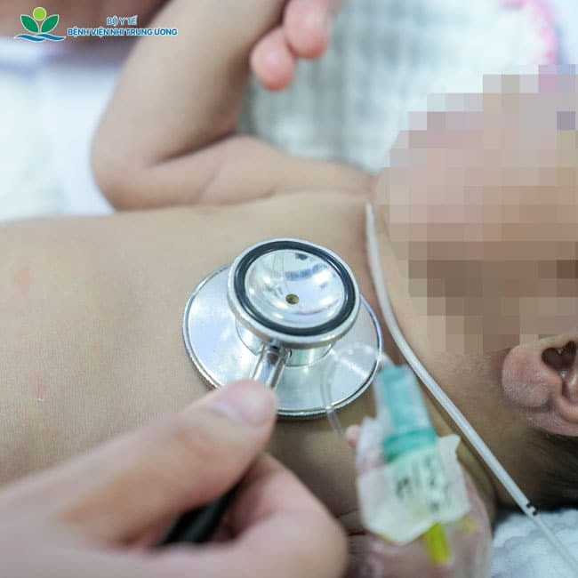 Bệnh nhi được theo dõi sát sao tại Trung tâm Sơ sinh trong những ngày đầu nhập viện (Ảnh: BVCC)