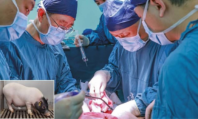 Các bác sĩ đã thực hiện ca ghép dị chủng kết hợp đầu tiên trên thế giới, đưa một lá gan và hai quả thận từ lợn biến đổi gene vào cơ thể người (Ảnh minh họa: SCMP)