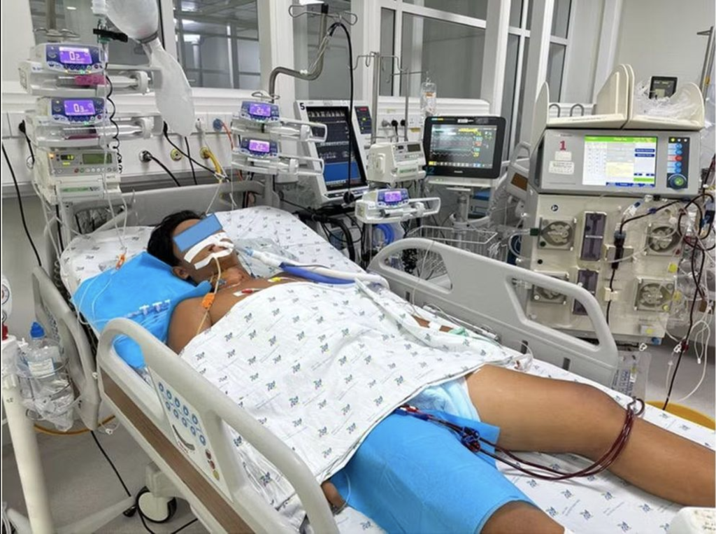 Bệnh nhi Tr.X.V. nhập viện trong tình trạng sốc nhiệt nặng, kèm tổn thương gan, tụy, thận cấp và được điều trị tích cực bằng thở máy, chống sốc, lọc máu liên tục (Ảnh: BVCC)
