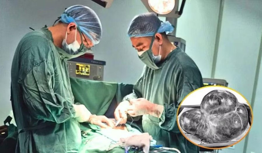 Các bác sĩ thực hiện phẫu thuật, loại bỏ khối u lớn (Ảnh: BVCC)