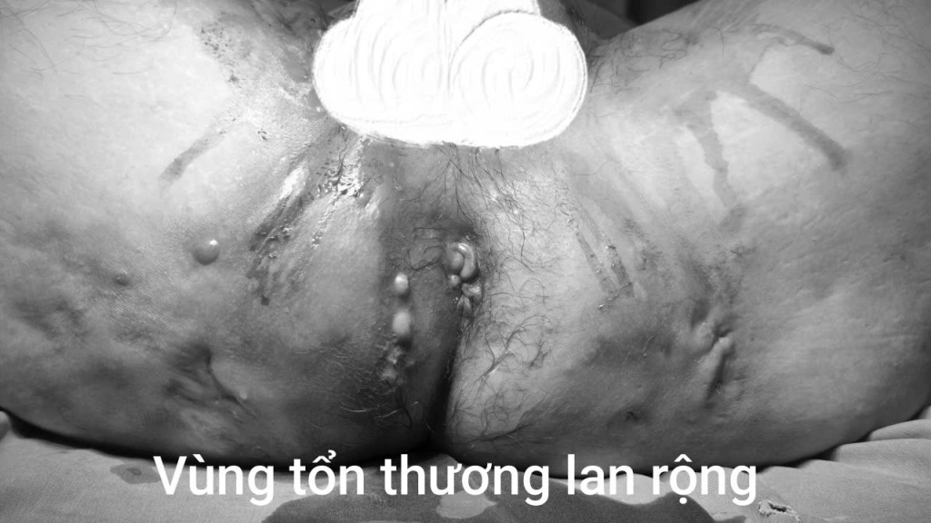 tu-nan-nhot-nam-thanh-nien-phai-lam-hau-mon-nhan-tao