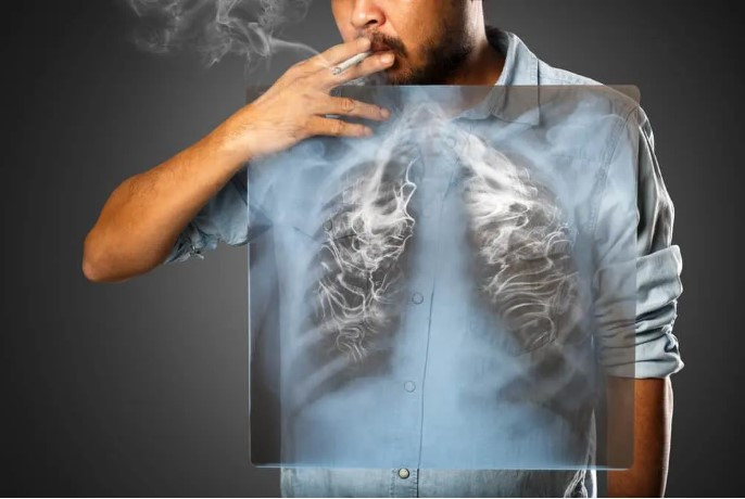 Ngoài các tác hại rất dễ nhận thấy trên đường hô hấp, thuốc lá còn gây nhiều bệnh lý trên đa cơ quan như tim mạch, nha khoa, võng mạc, tiêu hóa,… (Ảnh minh hoạ)