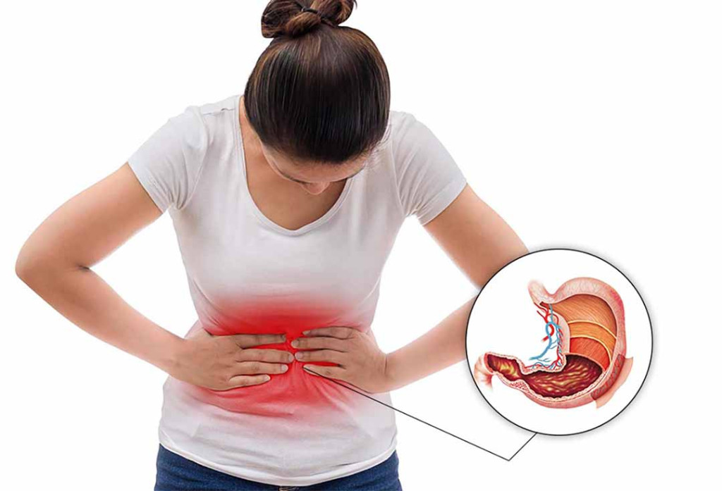 Lá vú sữa chỉ hỗ trợ giảm đau (Ảnh: Sưu tầm)