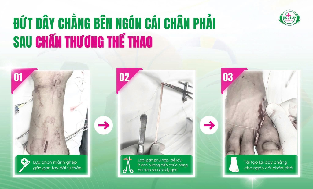 (Ảnh: Bệnh viện Hữu nghị Đa khoa Nghệ An)