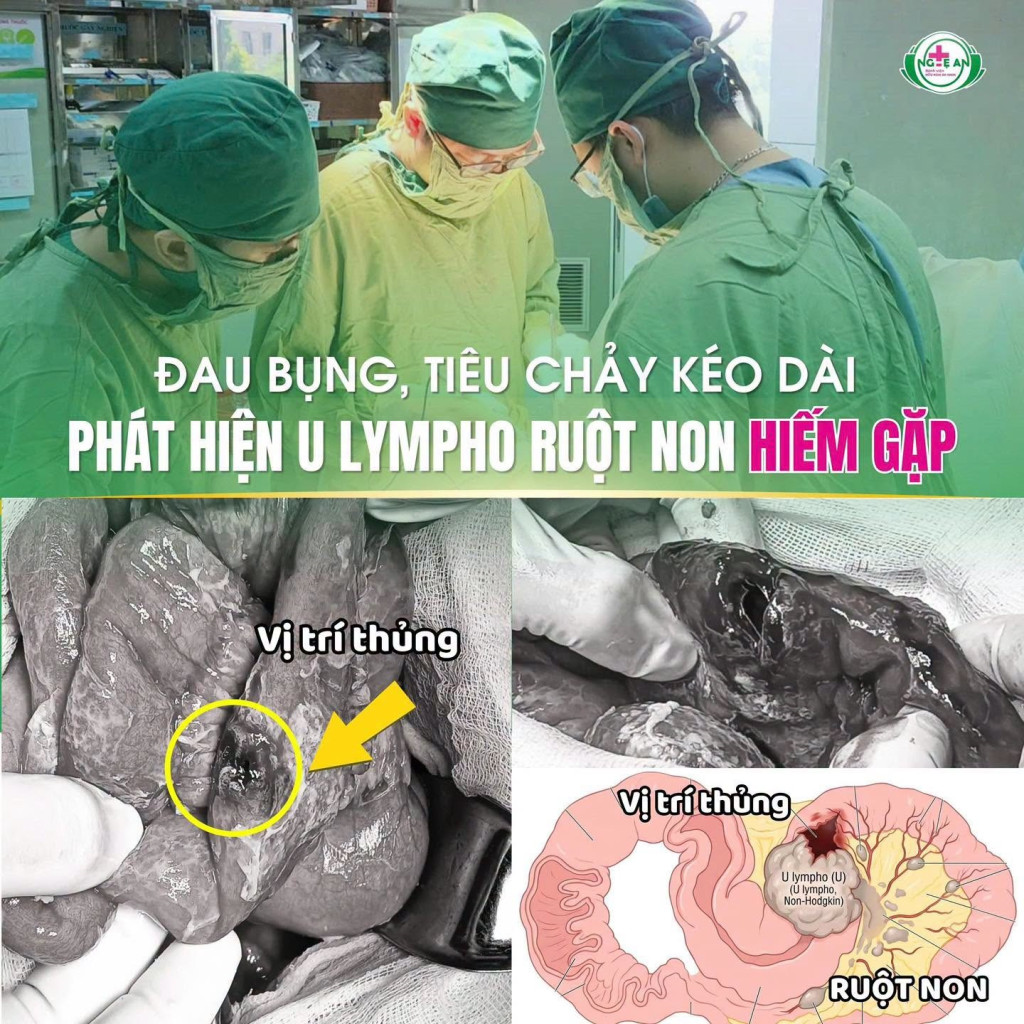 Các y bác sĩ phẫu thuật cho bệnh nhân (Ảnh: Bệnh viện Hữu nghị Đa khoa Nghệ An)