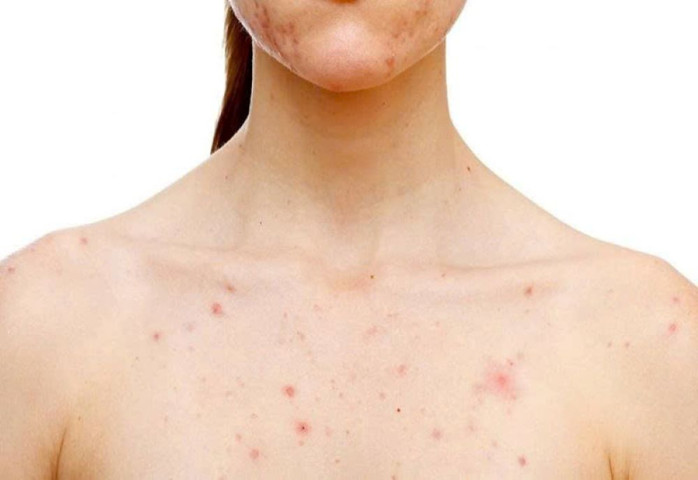 Detox thải độc gan: Hiệu quả thật hay chỉ là trào lưu?