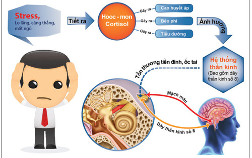 Rối loạn tiền đình có chữa khỏi được không?
