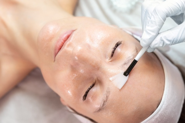 Trị mụn ẩn bằng peel da: Hiểu rõ trước khi thử
