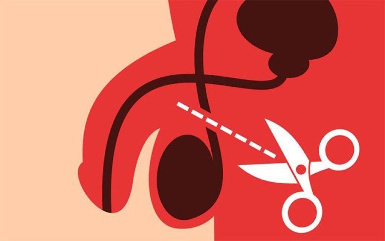 Thắt ống dẫn tinh có ảnh hưởng đến sinh lý nam giới không?