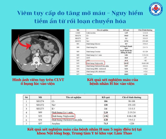 Phú Thọ: Viêm tụy cấp do tăng mỡ máu, nguy cơ tiềm ẩn từ rối loạn chuyển hóa