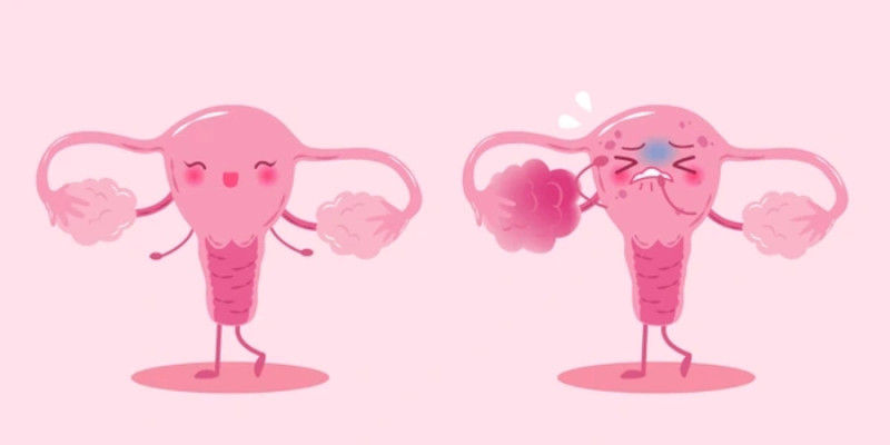 Vì sao bạn nên chăm sóc kỹ vùng kín mỗi ngày?