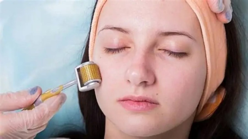 Những điều bạn cần biết về phương pháp lăn kim