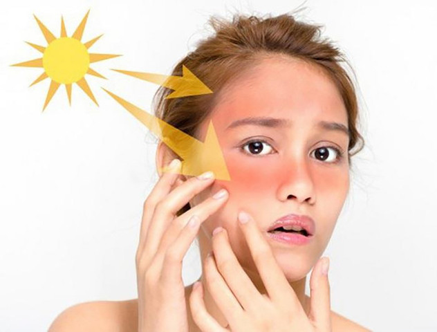 Viên uống chống nắng và những điều cần biết