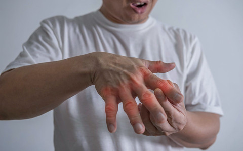 Cảnh báo thuốc chống viêm bị cấm vẫn “trôi nổi” trên mạng xã hội