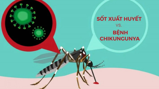 Sốt và đau khớp: Cách phân biệt Chikungunya và Dengue để không chủ quan “đánh trống bỏ dùi”