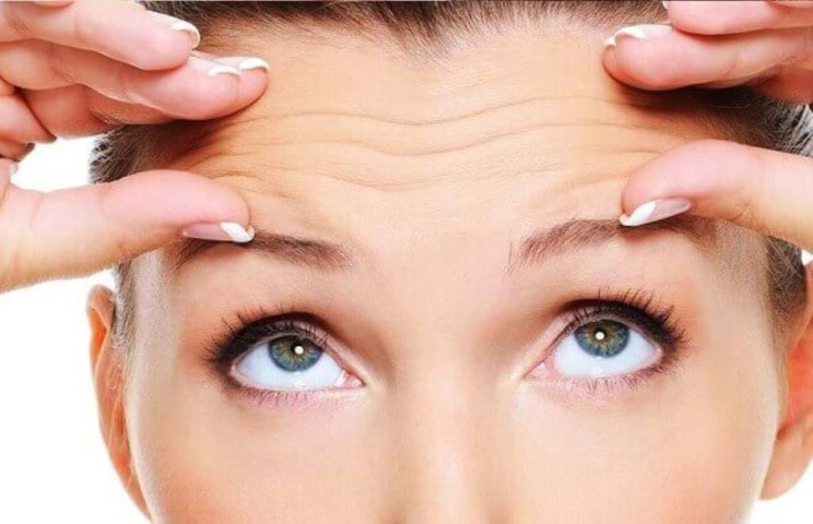 Vì sao nếp nhăn trên trán xuất hiện khi bạn còn trẻ?